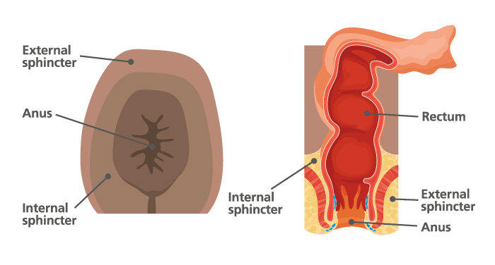 Medical diagrams - external diagram of the anus encased in the internal sphincter, which is encased within the external sphincter, and internal diagram of the anus, with the internal and external sphincter and rectum.